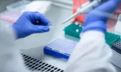 విజయవాడ బాలిక కేసు..మంకీపాక్స్ కాదు విజయవాడ బాలిక కేసు..మంకీపాక్స్ కాదు