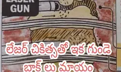 గుండె బ్లాక్ లను మాయం చేసే కొత్త టెక్నాలజీ